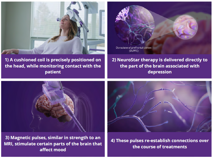 NeuroStar TMS delivers therapeutic magnetic pulses with the right dose, at the
right location each treatment to re-establish underactive neural connections